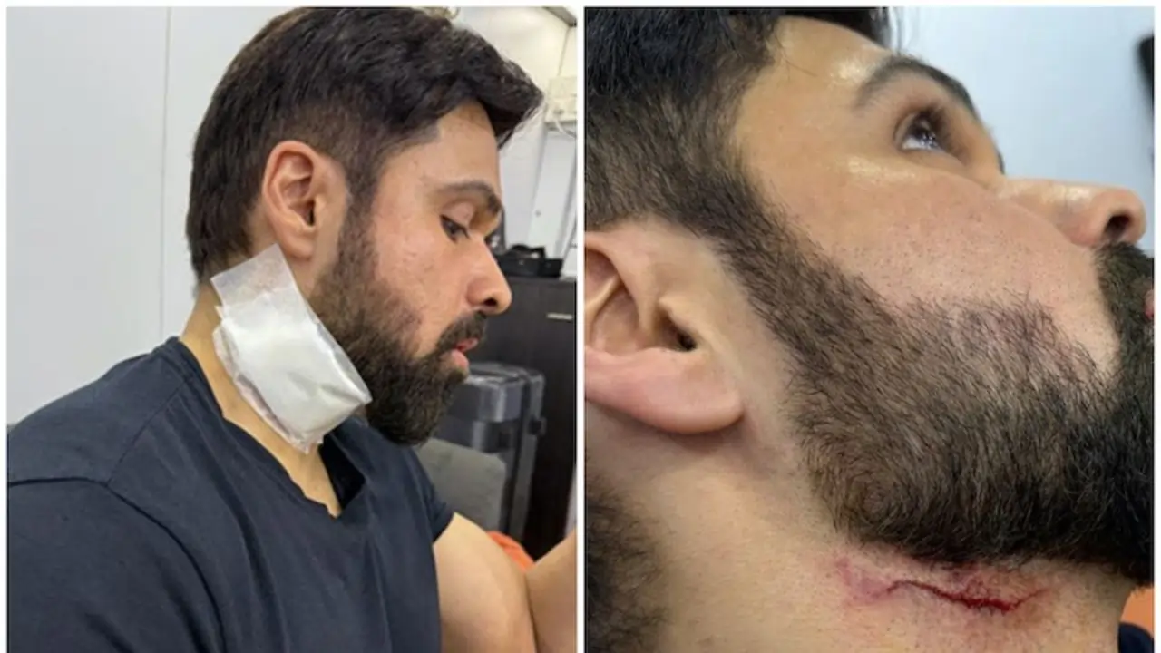 https://www.mobilemasala.com/film-gossip-hi/Emraan-Hashmi-injured-on-the-sets-of-Goodachari-2-hi-i306759